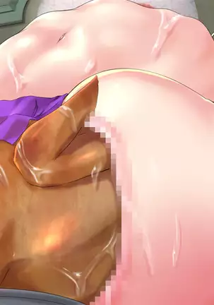 FEASsT, or rectal gastronomy 3