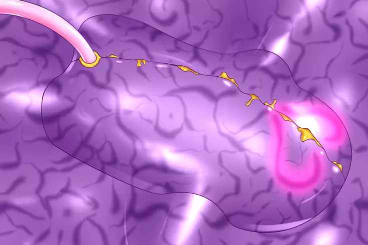 Symbiosis By Force 2 -Evolution-