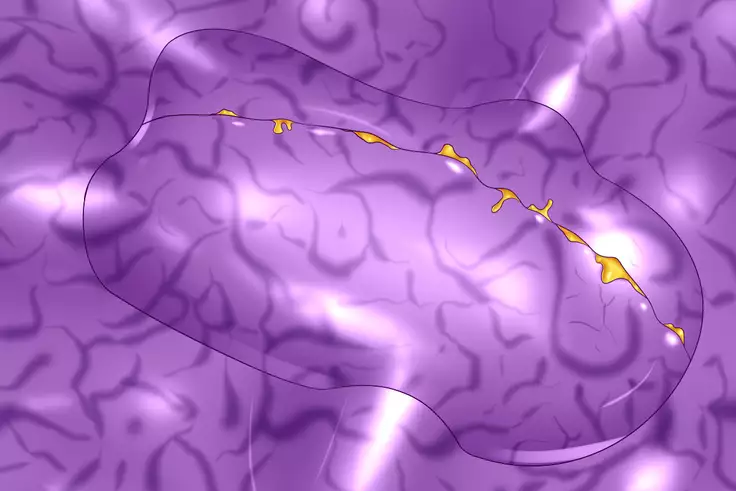 Symbiosis By Force 2 -Evolution-